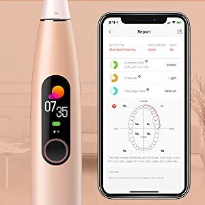 Умная электрическая зубная щетка Xiaomi Oclean X Pro Smart Sonic Electric Toothbrush Sakura Pink Умная электрическая зубная щетка Xiaomi Oclean X Pro Smart Sonic Electric Toothbrush Sakura Pink